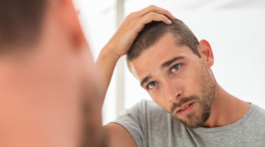 Evo kako je povezana konzumacija slatkih pića i gubitak kose kod muškaraca